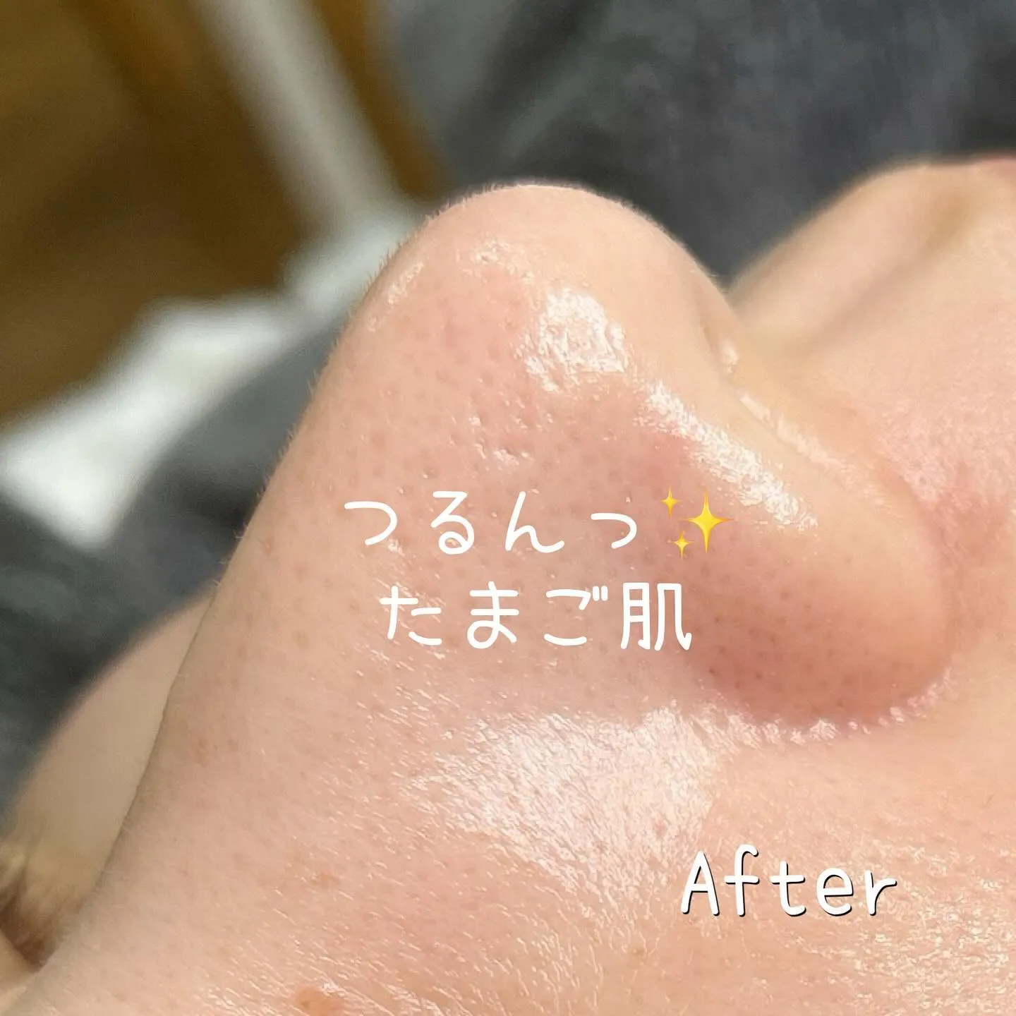 毛穴、産毛、角質ケアで叶う✨