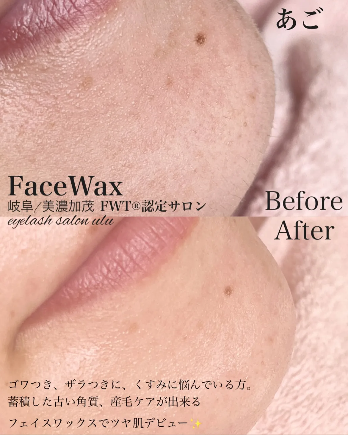 古い角質、ため込んでいませんか？