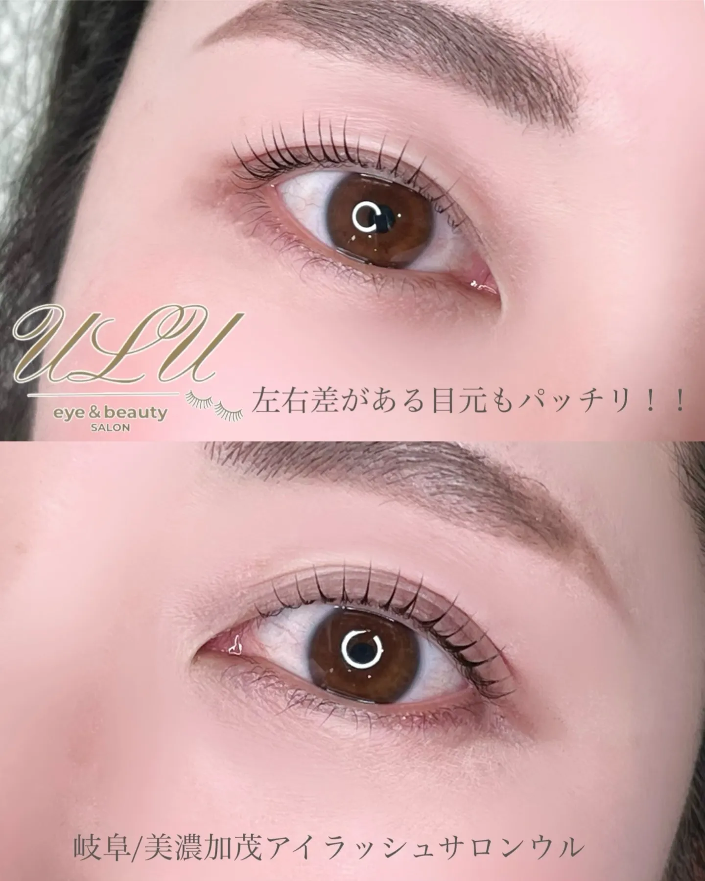 「左右で目の開きが揃ってきて感動…！」